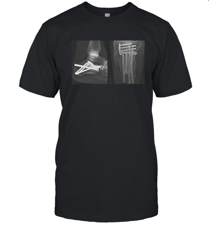 Kid CuDi The Tour That Never Was Skeleton Shirt