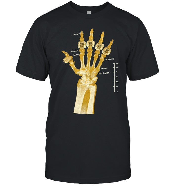 Kobe Bryant’s Broken Not Beaten X-Ray Shirt